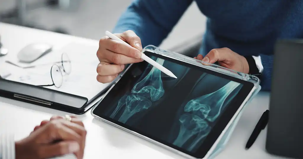 dr explaining xray finding